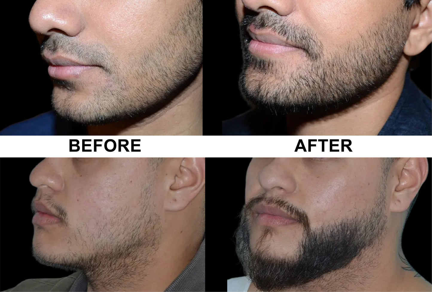 Beard Growth kit